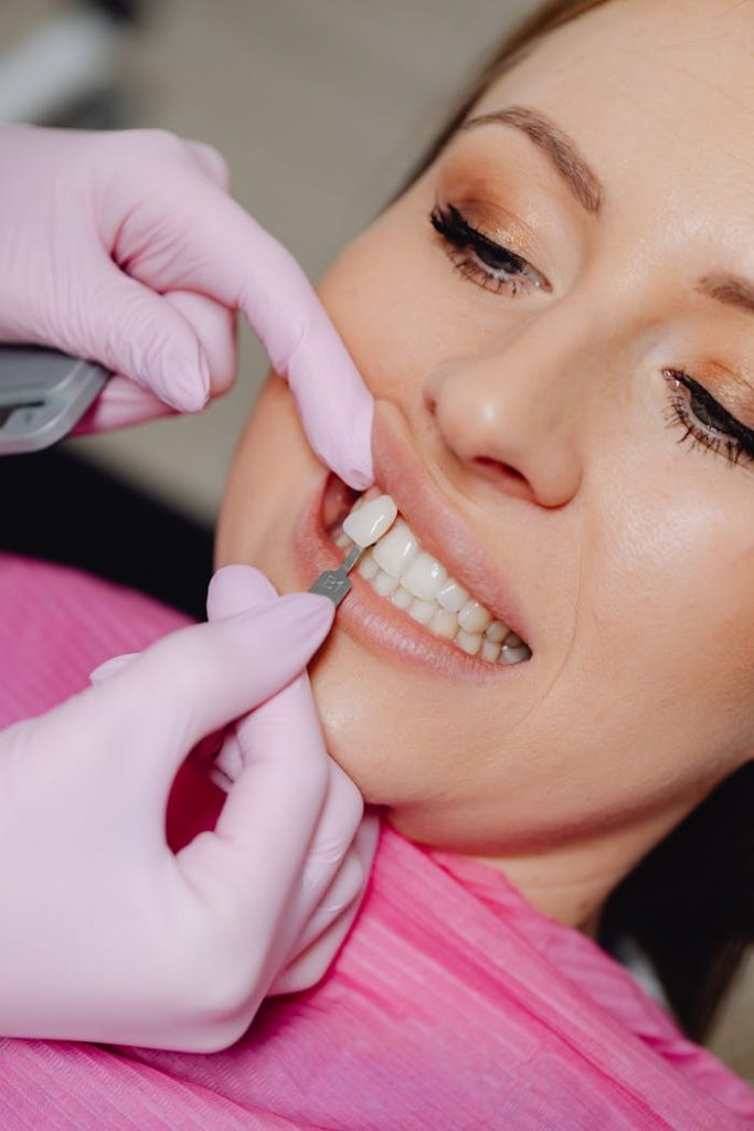 Detailed shot of a dentist applying veneer to a womans teeth during a dental procedure.